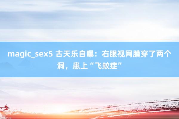 magic_sex5 古天乐自曝：右眼视网膜穿了两个洞，患上“飞蚊症”